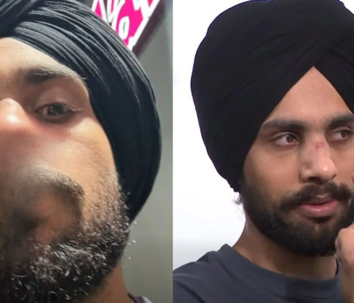 Racial abuse in Australia | ಆಸ್ಟ್ರೇಲಿಯಾದಲ್ಲಿ ಜನಾಂಗೀಯ ನಿಂದನೆ: ಭಾರತ ಮೂಲದ ನರ್ಸ್ ಮೇಲೆ ಹಲ್ಲೆ | Speed News Kannada