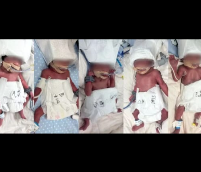 A mother who gave birth to 5 children in one delivery | ಒಂದೇ ಹೆರಿಗೆಯಲ್ಲಿ 5 ಮಕ್ಕಳಿಗೆ ಜನ್ಮ ನೀಡಿದ ಮಹಾತಾಯಿ | Speed News Kannada