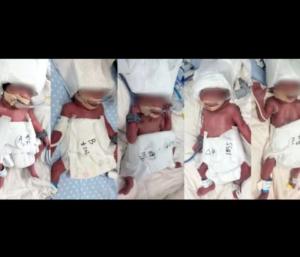 A mother who gave birth to 5 children in one delivery | ಒಂದೇ ಹೆರಿಗೆಯಲ್ಲಿ 5 ಮಕ್ಕಳಿಗೆ ಜನ್ಮ ನೀಡಿದ ಮಹಾತಾಯಿ | Speed News Kannada
