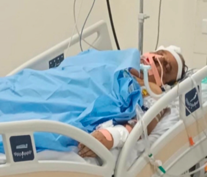 Sudhakar health condition is critical, a host of dignitaries visit the hospital|ಸುಧಾಕರ್ ಆರೋಗ್ಯ ಸ್ಥಿತಿ ಗಂಭೀರ, ಆಸ್ಪತ್ರೆಗೆ ಗಣ್ಯರ ದಂಡು|Speed News Kannada