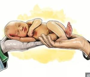 Mysore calf dies due to doctor negligence | ವೈದ್ಯರ ನಿರ್ಲಕ್ಷ್ಯಕ್ಕೆ ಮೈಸೂರಿನ ಹಸುಗೂಸು ಸಾವು | Speed news kannada 